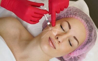 Ácido hialurónico: o que é, tipos e como se aplica na medicina estética